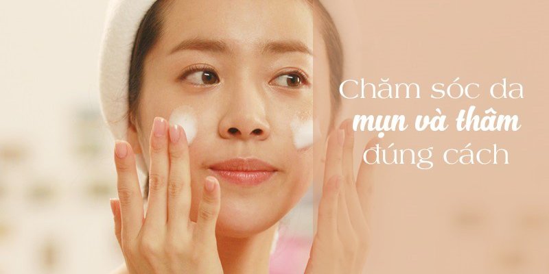 Cách chăm sóc da mụn hiệu quả