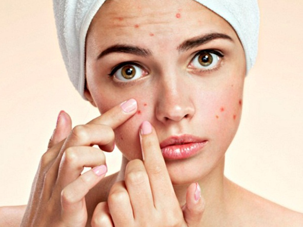 Cách chăm sóc da mụn hiệu quả