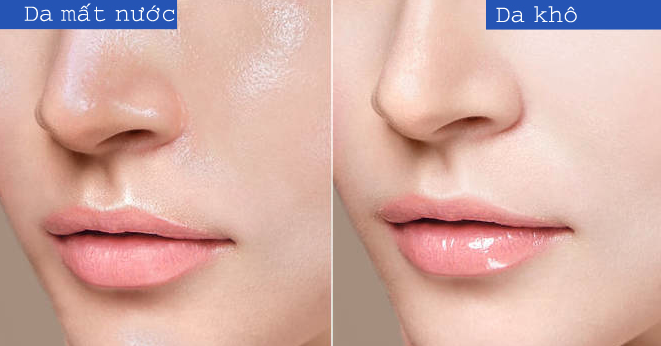 Cách chọn kem dưỡng ẩm cho da khô