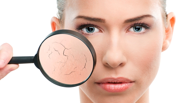 Cách chọn kem dưỡng ẩm cho da khô