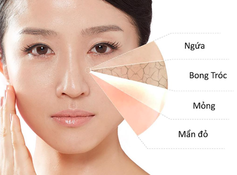 Kem dưỡng da nào tốt cho phái đẹp