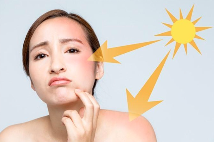 Kem chống nắng có thực sự tốt
