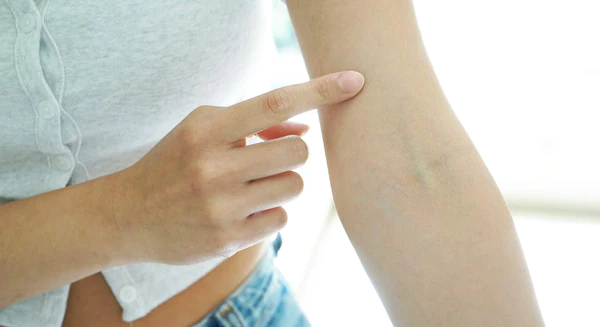 Kiểm Tra Phản Ứng Da Khi Sử Dụng Sản Phẩm Chăm Sóc Da